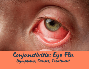 Conjunctivitis: Eye Flu - Understanding Symptoms, Causes, and Treatment